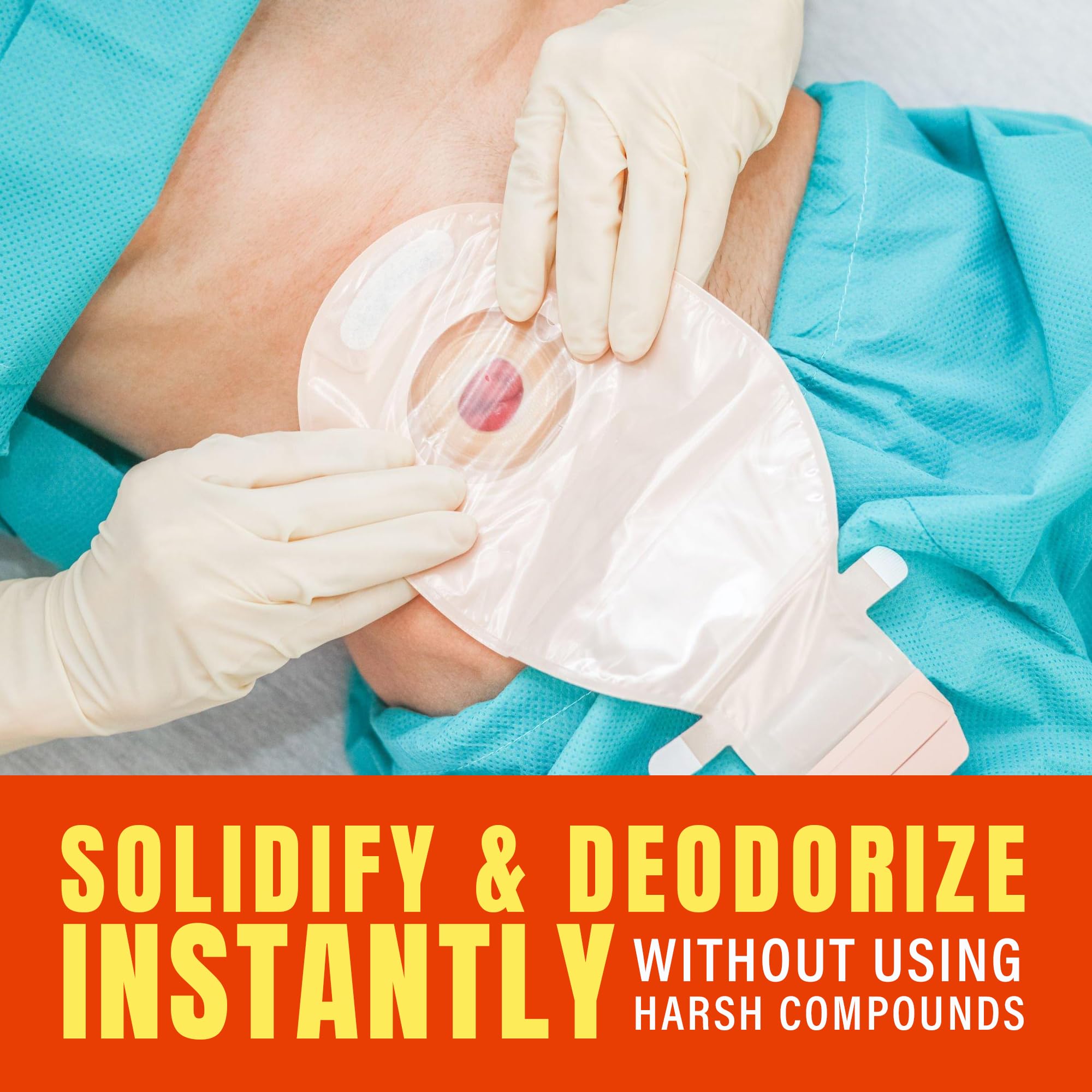 SMELLEZE Ostomy Bag Odor Eliminator: 50 lb. Granules Stop Embarrassing Ostomy, Colostomy, Stoma & Ileostomy Odor