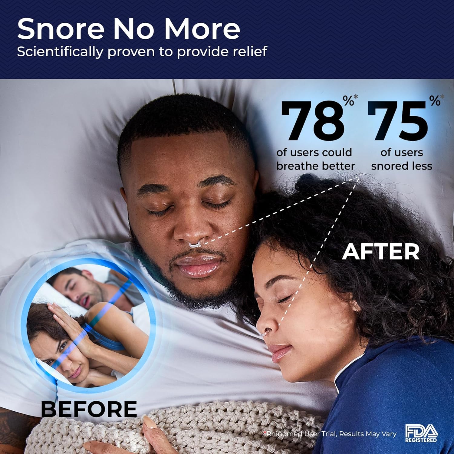 Rhinomed Mute Nasal Dilator - Anti-Snoring Aid, Transparent, 3 Pack Starter - Comfortable Breathing Aids for Better Sleep