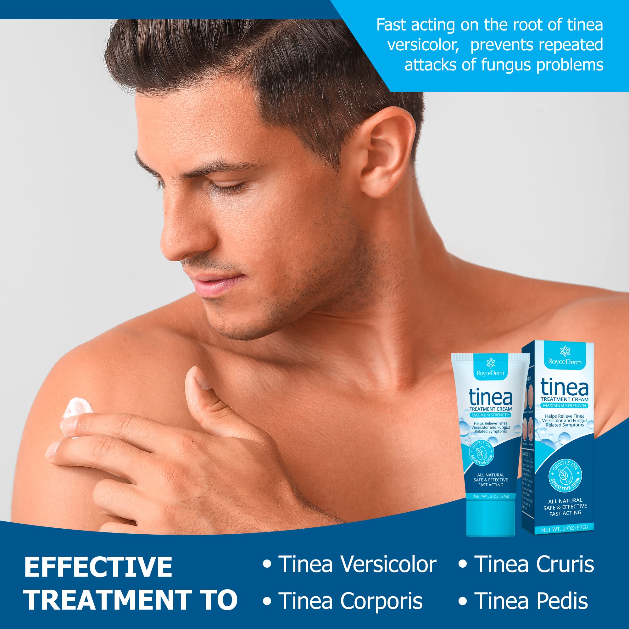 Roycederm Tinea Versicolor Treatment, Athletes Foot Treatment, Ringworm Treatment For humans, Antifungal Cream for Tinea Versico