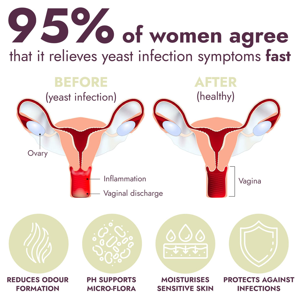 Yeast Infection Treatment for Women | Antifungal Ointment Helps Relieve Itching & Irritation | Vaginal Aid for Inflammation, Dry