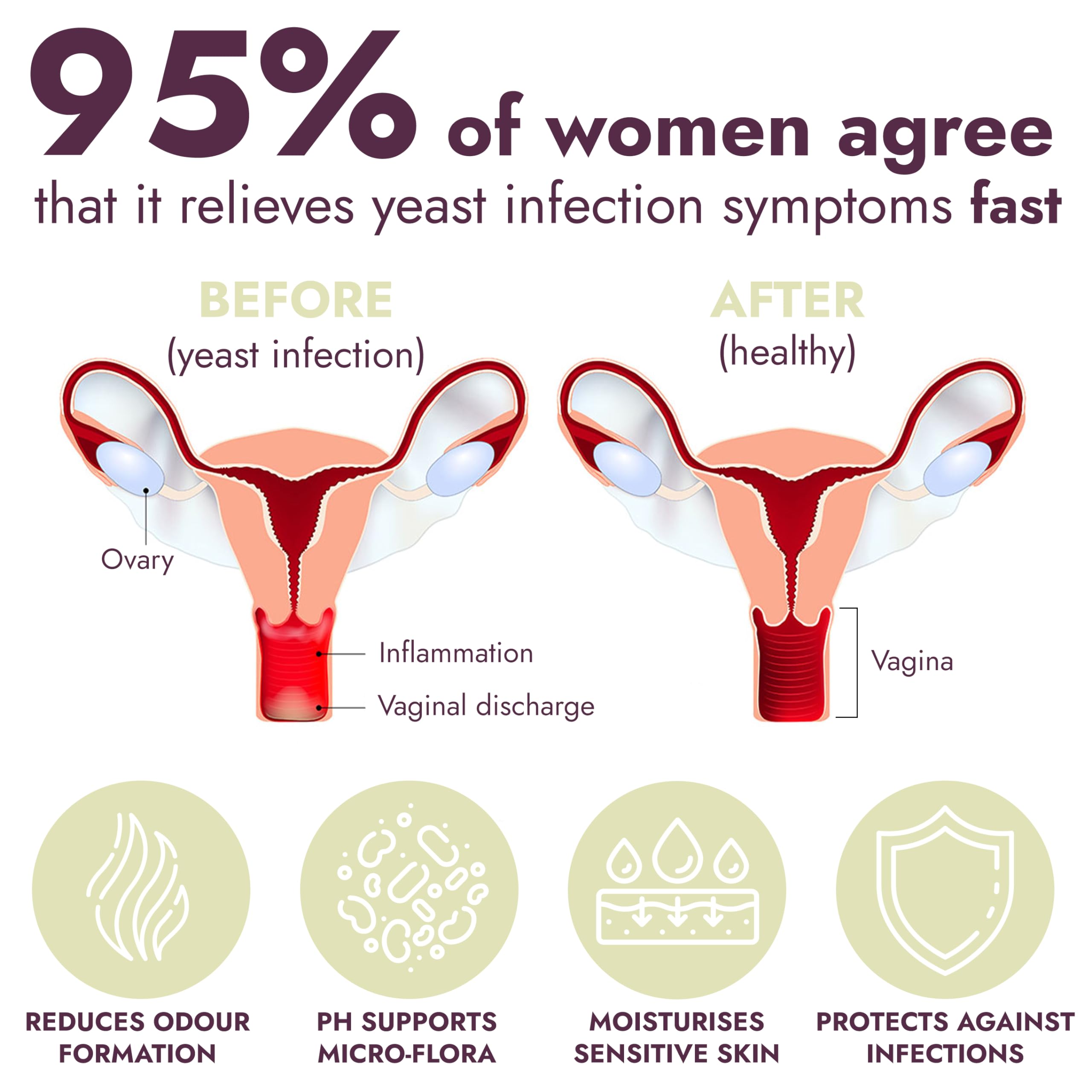 Yeast Infection Treatment for Women | Antifungal Ointment Helps Relieve Itching & Irritation | Vaginal Aid for Inflammation, Dry