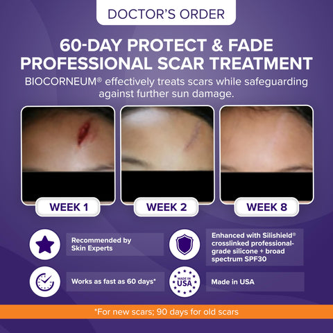 Advanced Scar Treatment with Silishield & SPF 30 50g - Made in the USA, Fast-Drying, Water-Resistant Silicone Scar Gel - Surgeon