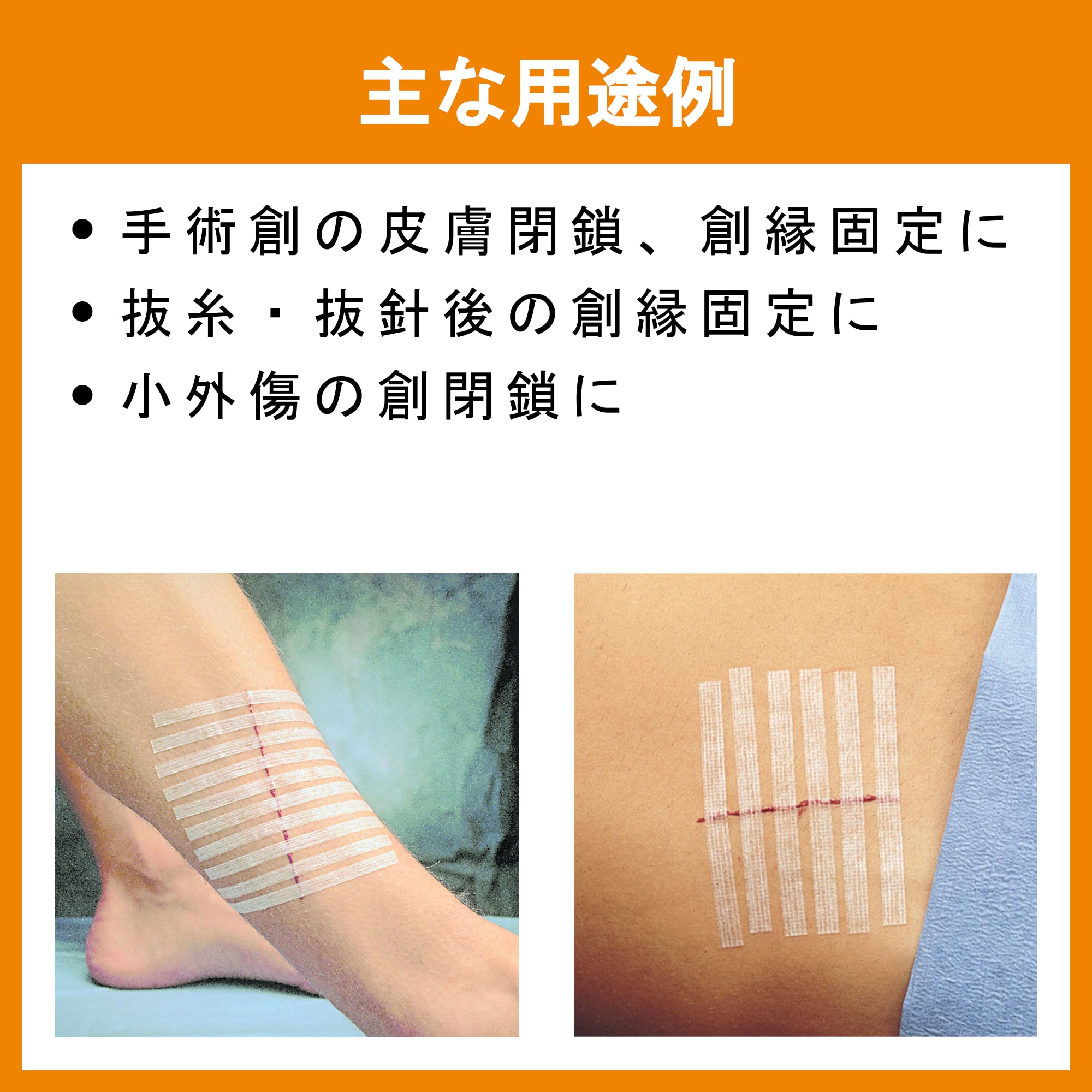 Minnesota 3M Healthcare Steri-Strip 1/4 x 4, Reinforced Category: Specialty Dressings Woundcare Products (10 Strips)
