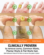 Wart Corn Remover Pads for Feet: 42 Pack 40% Salicylic Acid Extra Strength Bandages for Plantar Warts Corns Small Callus on Feet