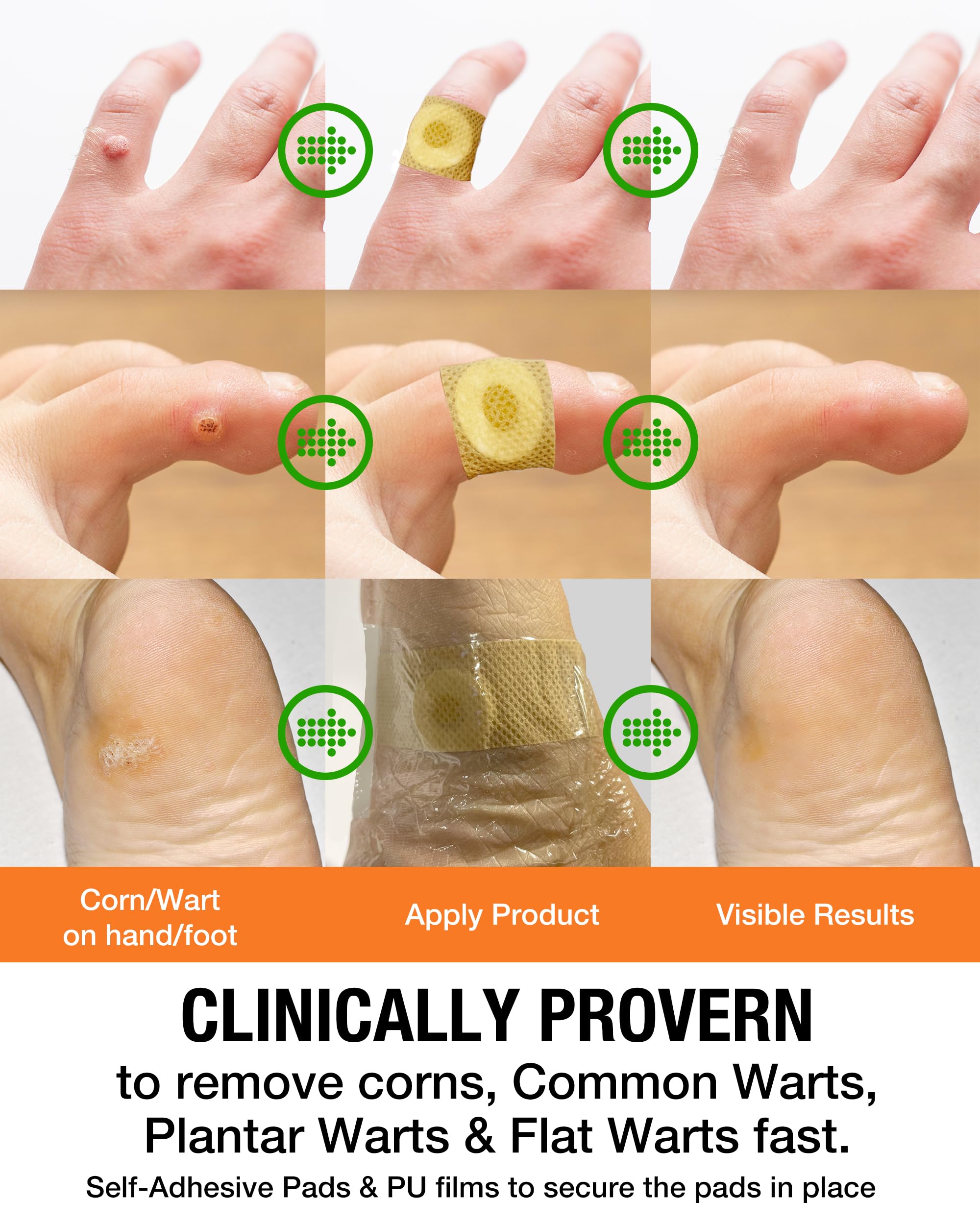 Wart Corn Remover Pads for Feet: 42 Pack 40% Salicylic Acid Extra Strength Bandages for Plantar Warts Corns Small Callus on Feet