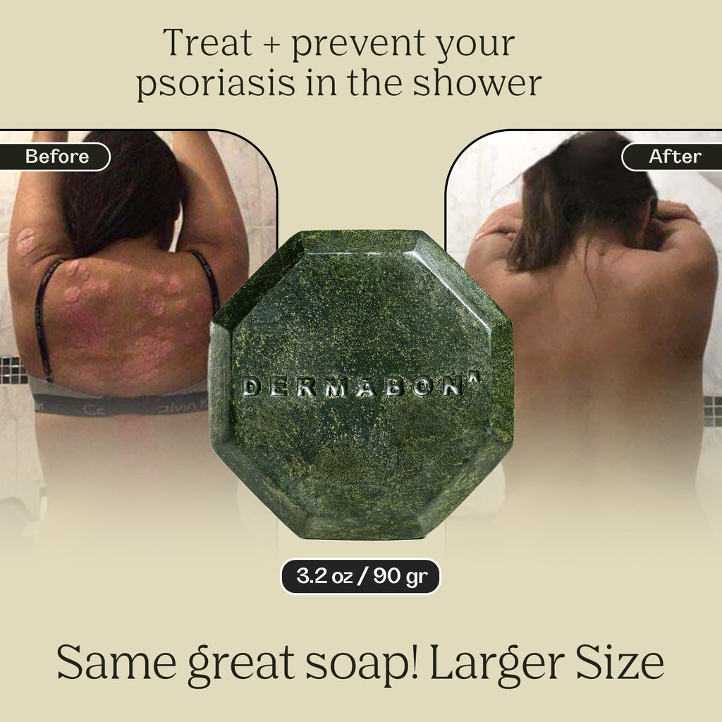 Dermabon 2% Coal Tar Psoriasis Body Wash & Eczema Bar Soap (3 Pack) | Control and Relieve Psoriasis, Eczema, Dermatitis, and Dan