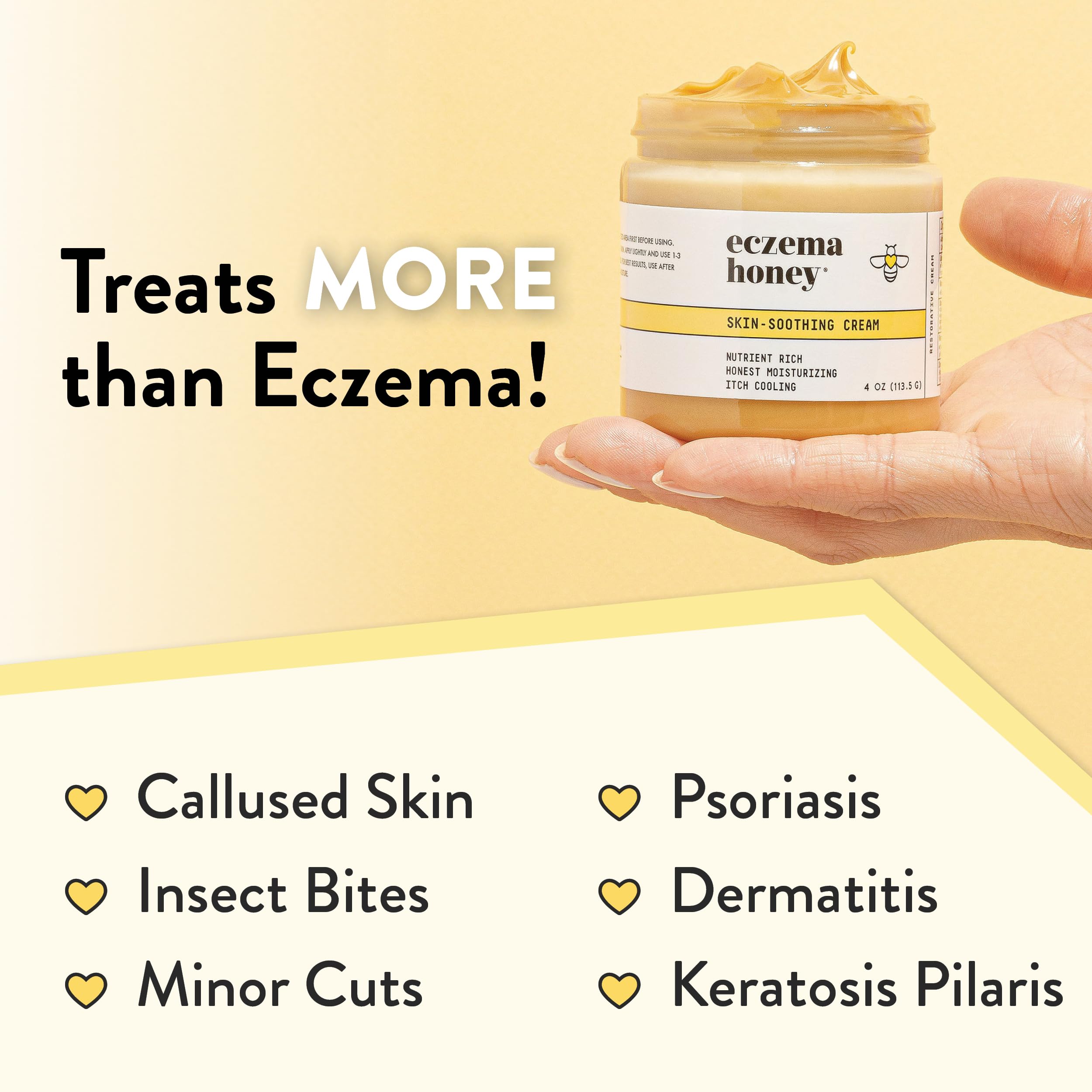 ECZEMA HONEY Original Skin-Soothing Cream - Organic Hand & Body Eczema Relief - Natural Honey Lotion for Dry, Itchy, & Irritable