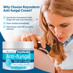 Roycederm Antifungal Cream, Athletes Foot Treatment Cream, Jock Itch Cream, Antifungal Treatment for Athletes Foot, Eczema, Psor