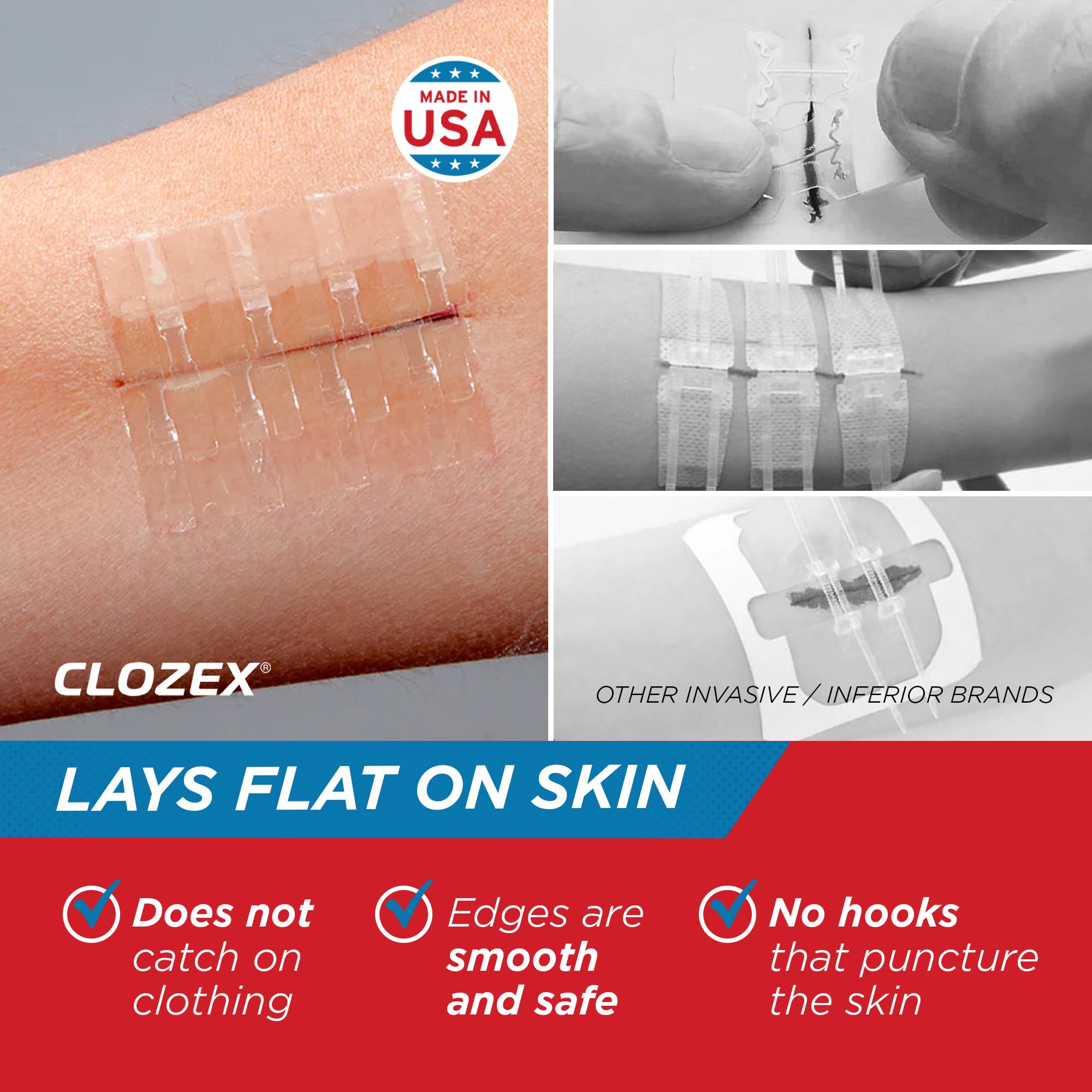 Clozex Complete Emergency Laceration Kit - Repair Wounds Without Stitches, FSA HSA Eligible Skin Clean Cover Closure Device for