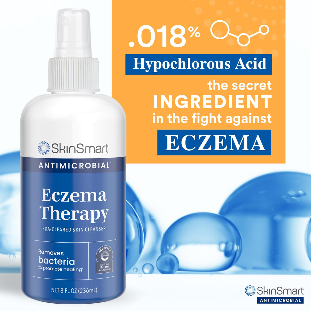 SkinSmart Eczema Therapy, Hypochlorous Antimicrobial Safely Removes Bacteria, so Your Skin Can Heal, Travel Size 2 Ounce Spray (