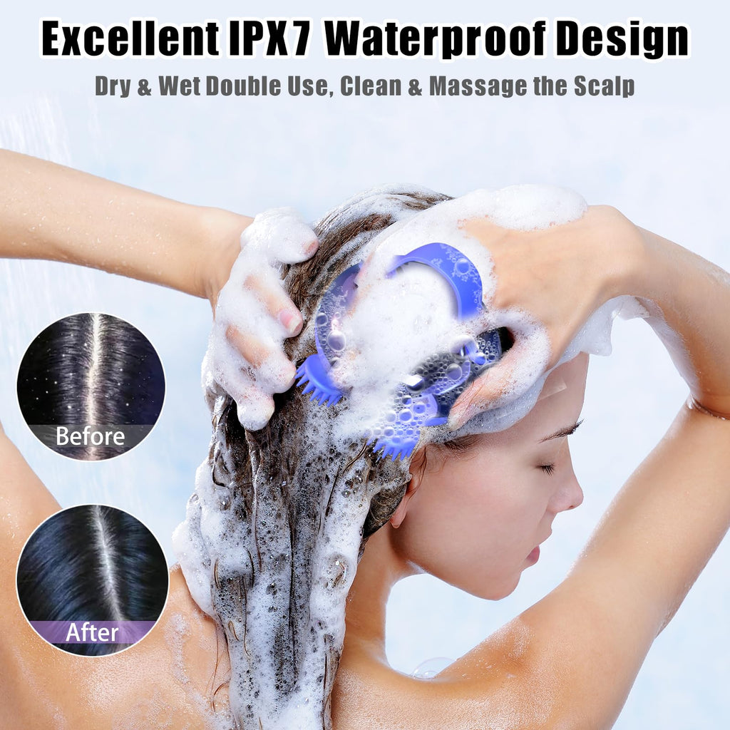 Viuyougor Scalp Massager - Electric, Portable Head Massager for Hair Growth, Waterproof, 3 Speed Modes & 8 Massage Claws