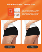 Rovista Anti Cellulite Massage Tool - Ergonomic Cellulite Remover for Legs and Arms with Detachable Handles - Smooth-Glide Lymph
