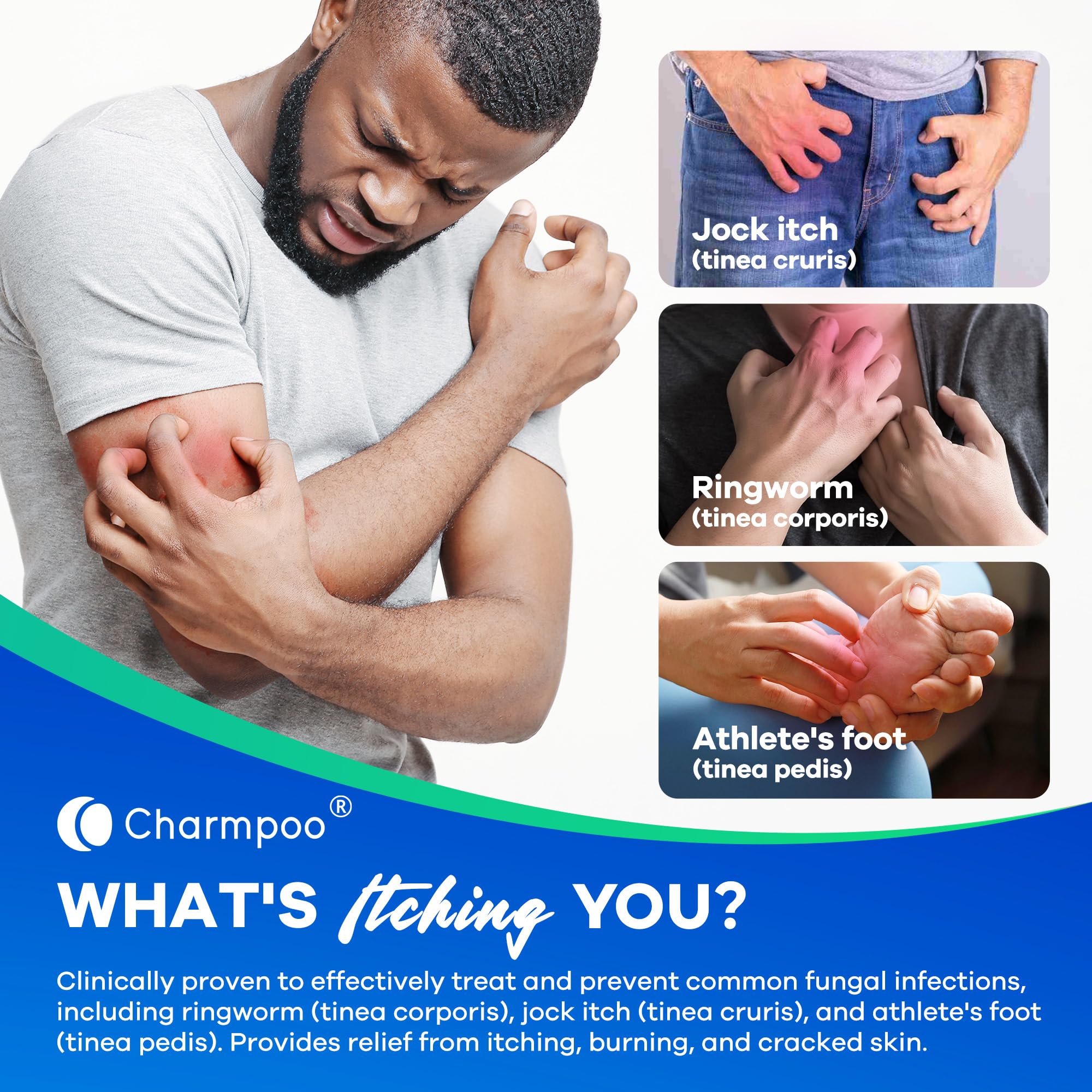 CHARMPOO Antifungal Soap Bar for Itchy Skin: Helps Relieve Athletes Foot & Fungal Discomfort - Moisturizing pH-Balanced Gentle o