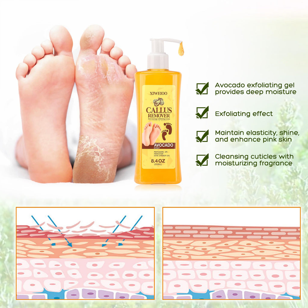 XIWEIOO Foot Callus Remover Gel Kit Heel Exfoliator Dead Skin Remover Pedicure Foot Spa Products Set Home Pedicure Foot Care Spa
