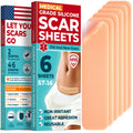 Medical Grade Silicone Scar Sheets - 6pk (5.7   x1.6   ) - Visible Difference on Surgical & Keloid Marks - Reusable C-Section Sc