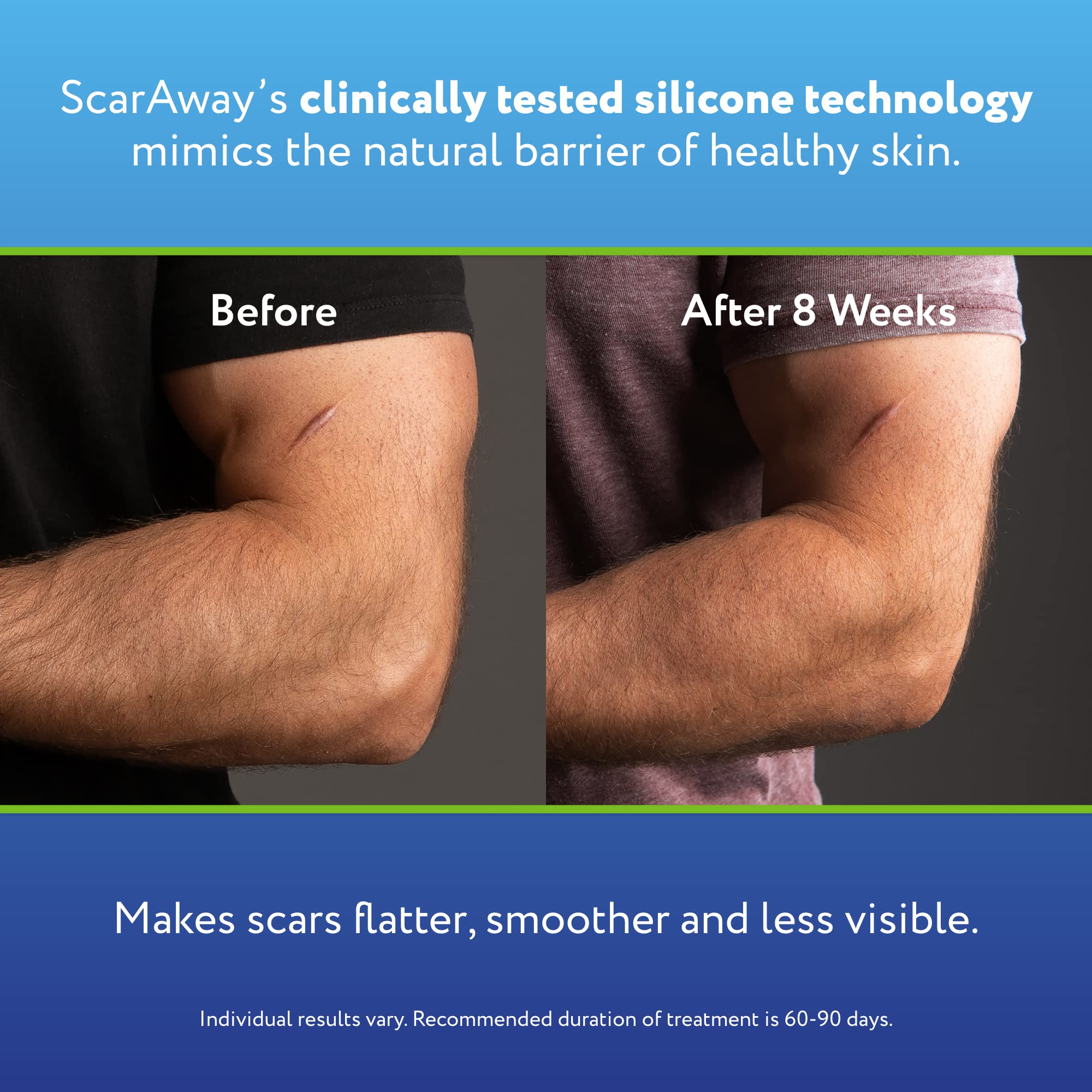 ScarAway Advanced Silicone Scar Sheets, Medical Grade Variety Pack Silicone Strips, Scar Treatment & Prevention for Surgical, Bu