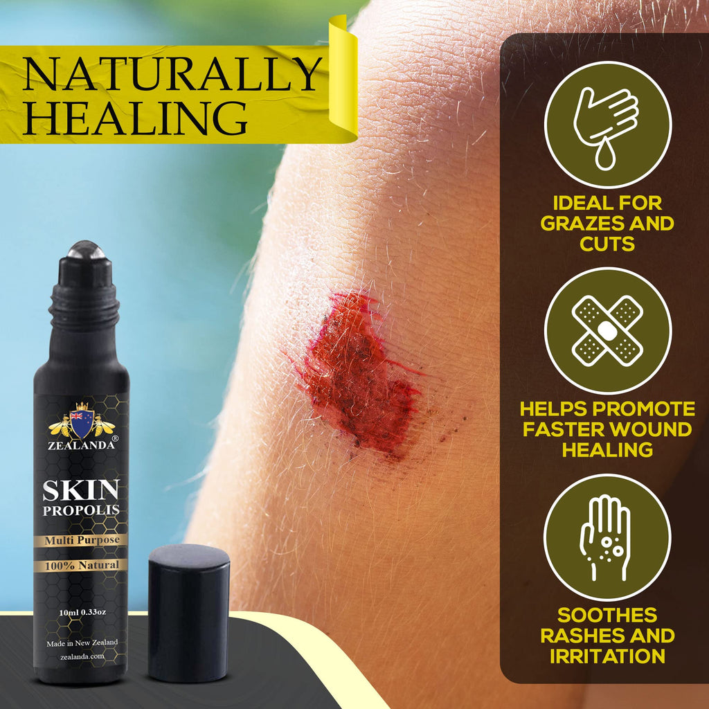 ZEALANDA Skin Propolis, Multi Purpose 100% Natural, Alcohol-Free for Acne, Pimple, Eczema, Callus, Sunspot,Skin Rash, Insect Bit