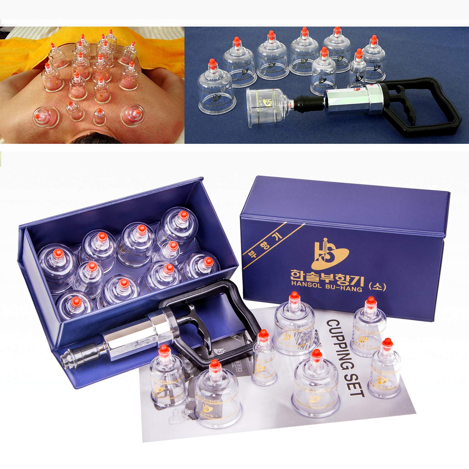 Hansol Professional Cupping Therapy Equipment Set with pumping handle 10 Cups & English Manual (Made in Korea)