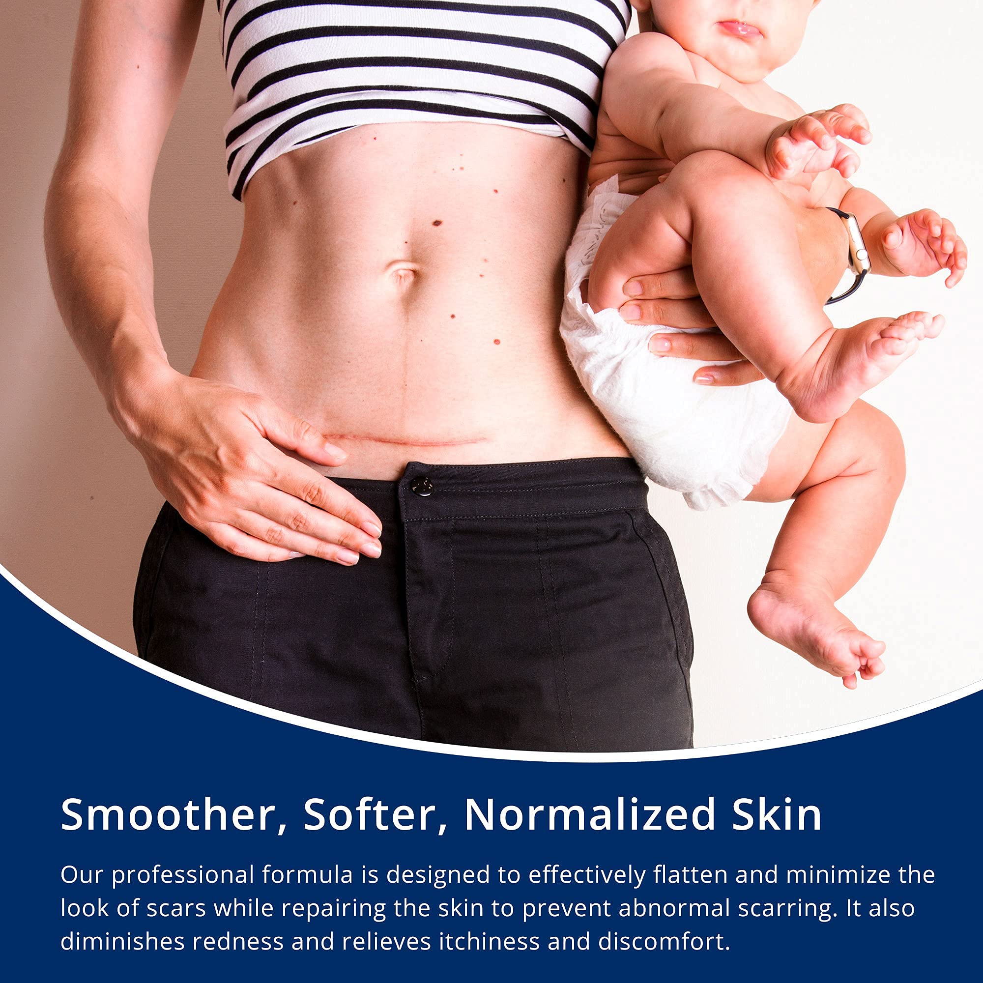 100% Silicone Scar Gel Scar Cream - Advanced Scar Gel for Surgical Scars, C-Section, Stretch Marks, Acne, Injury, Burns, Keloids