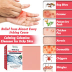 Natural Instant Itch Relief Soap Bar - Calming Calamine Soap for Itchy Skin, Bug Insect Mosquito or Ant Bite, Eczema, Poison Ivy