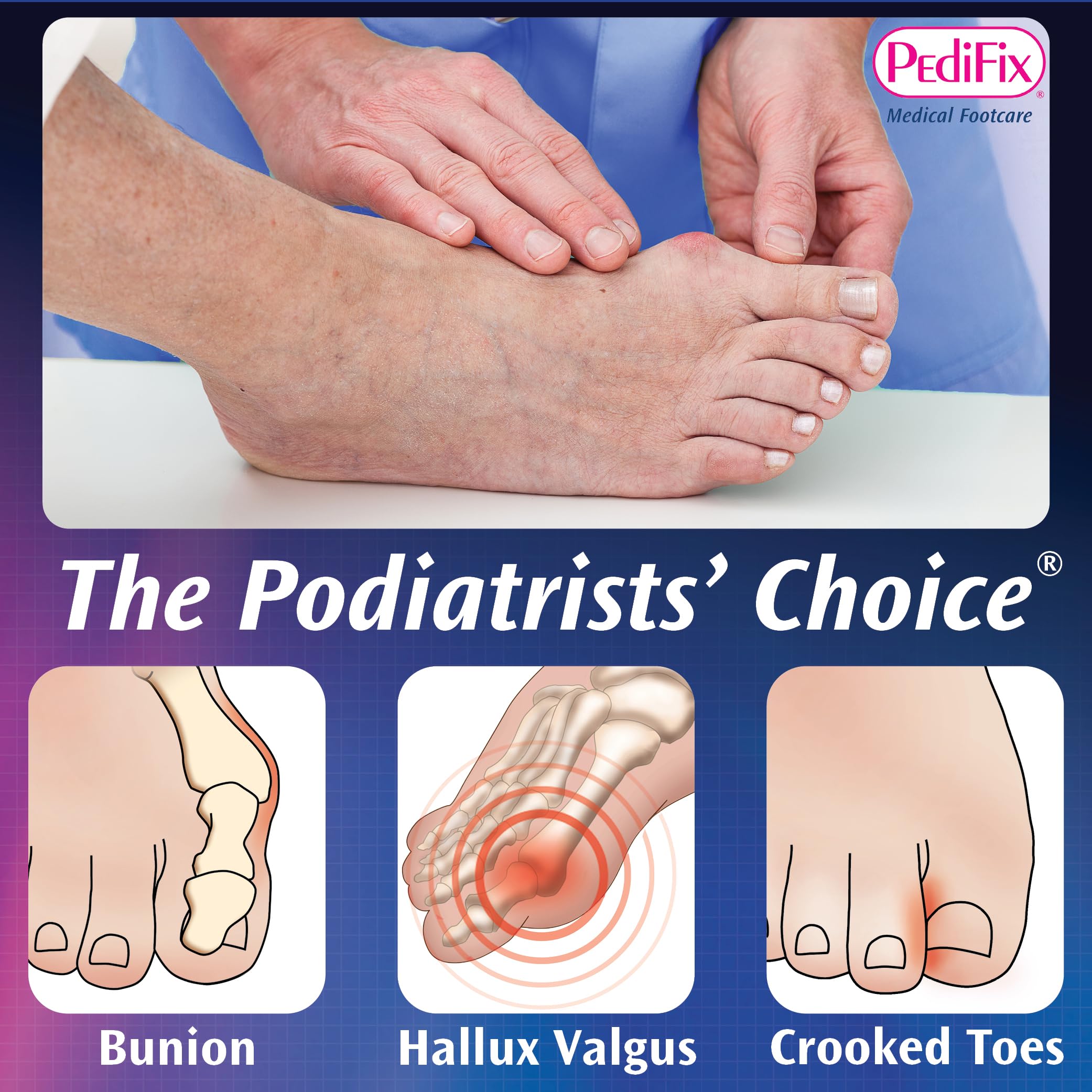 PediFix Nighttime Bunion Regulator, Large Left