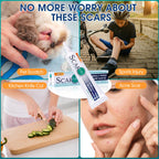 ScarMD Medical Grade Silicone Scar Gel Treatment,Keloid Bump Removal,Fades Scars from Surgery, Burn Scar,Face Belly Piercings, C