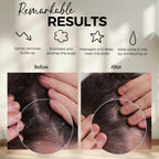 Fiora Naturals Scalp Massager Shampoo Brush - Silicon Scalp Scrubber & Exfoliator for Dandruff Removal and Hair Growth, Scalp Br