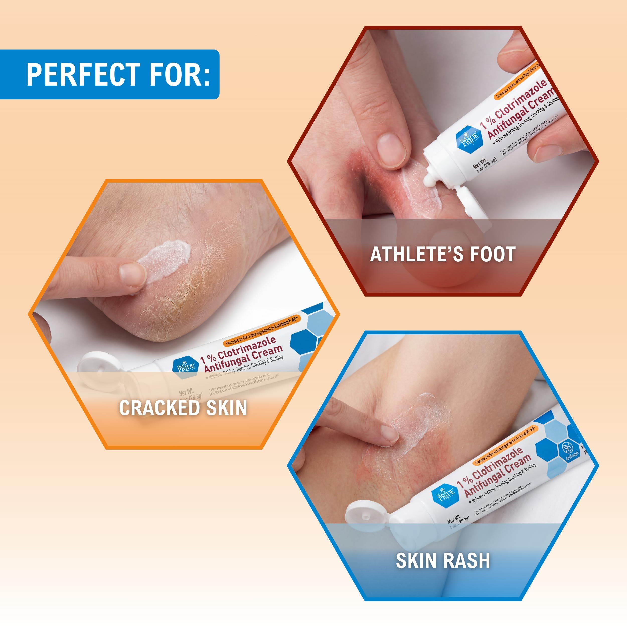 MED PRIDE 1% Clotrimazole Antifungal Cream 1oz- Fungus Skin Care Treatment with - Jock Itch Body Ointment - Fights Infection, Sw