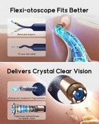 Bebird Earsight Plus Ear Cleaning Camera Wax Removal Tool kit, Flexible Ear Scope Otoscope Camera Light, Visual Ear Picker Wirel