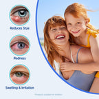 Roycederm Stye Eye Treatment Relief Spray - Hypochlorous Acid Mist for Itchy, Dryness Eyelids & Makeup Removal - Eyelash, Eyelid