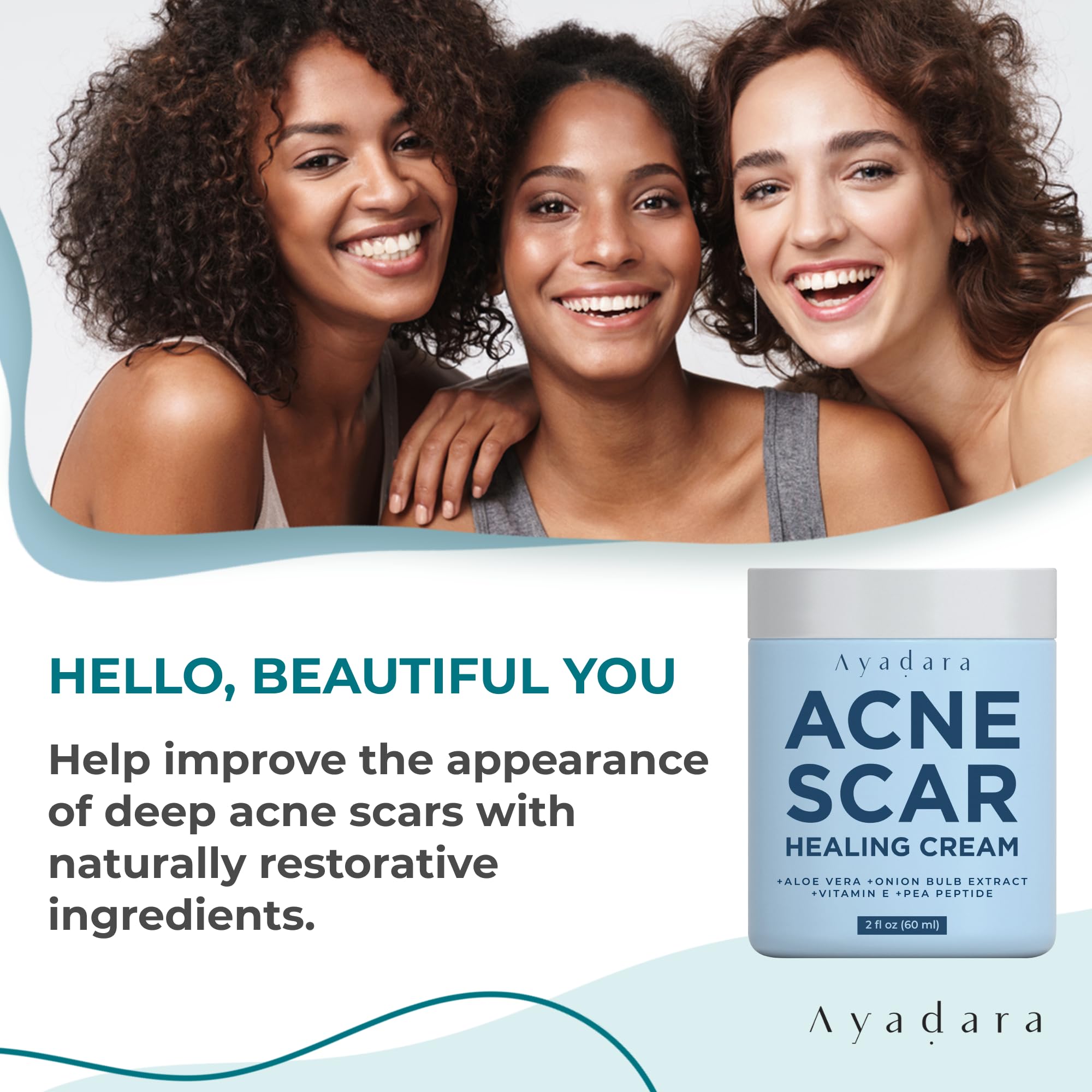 Ayadara Acne Scar Healing Cream, 2 fl oz, Acne Scar Treatment for Face, Stretch Marks, Body Scars, Acne Scar Removal Cream for B