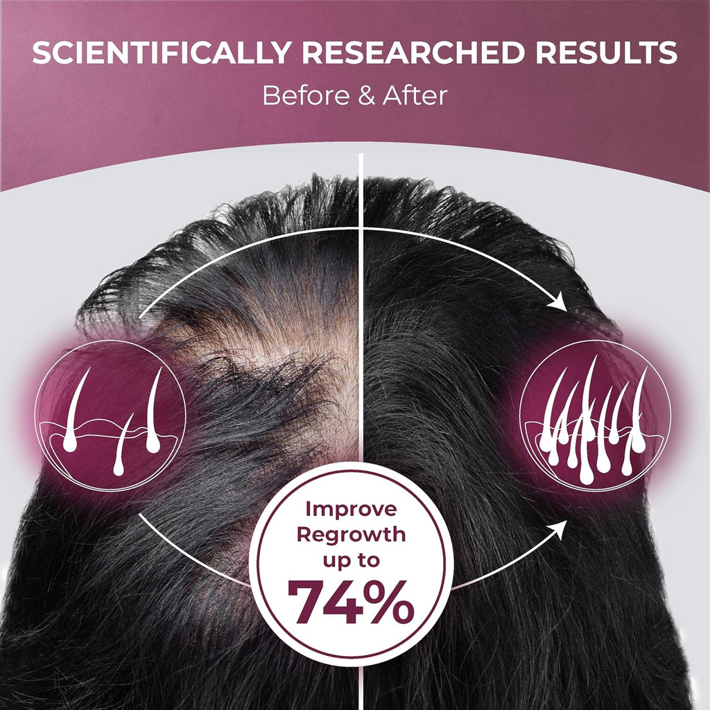 ReGrow Hair Growth Vitamins with Biotin, Hair Supplement by PureHealth Research