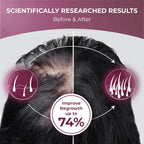 ReGrow Hair Growth Vitamins with Biotin, Hair Supplement by PureHealth Research