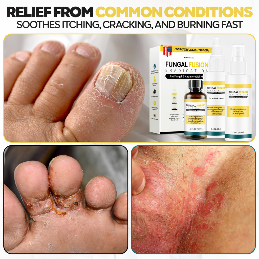 DOCTORS INC. Toenail Fungus Treatment Extra Strength Antifungal Solution - Made in USA - Repairs Fungal Damaged, Yellow, Thick,