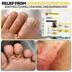 DOCTORS INC. Toenail Fungus Treatment Extra Strength Antifungal Solution - Made in USA - Repairs Fungal Damaged, Yellow, Thick,