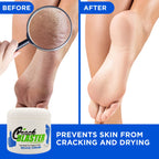 Dry Skin Lanolin Cream for Cracked Heels, Elbows and Soft Hands Crack Blaster Revive