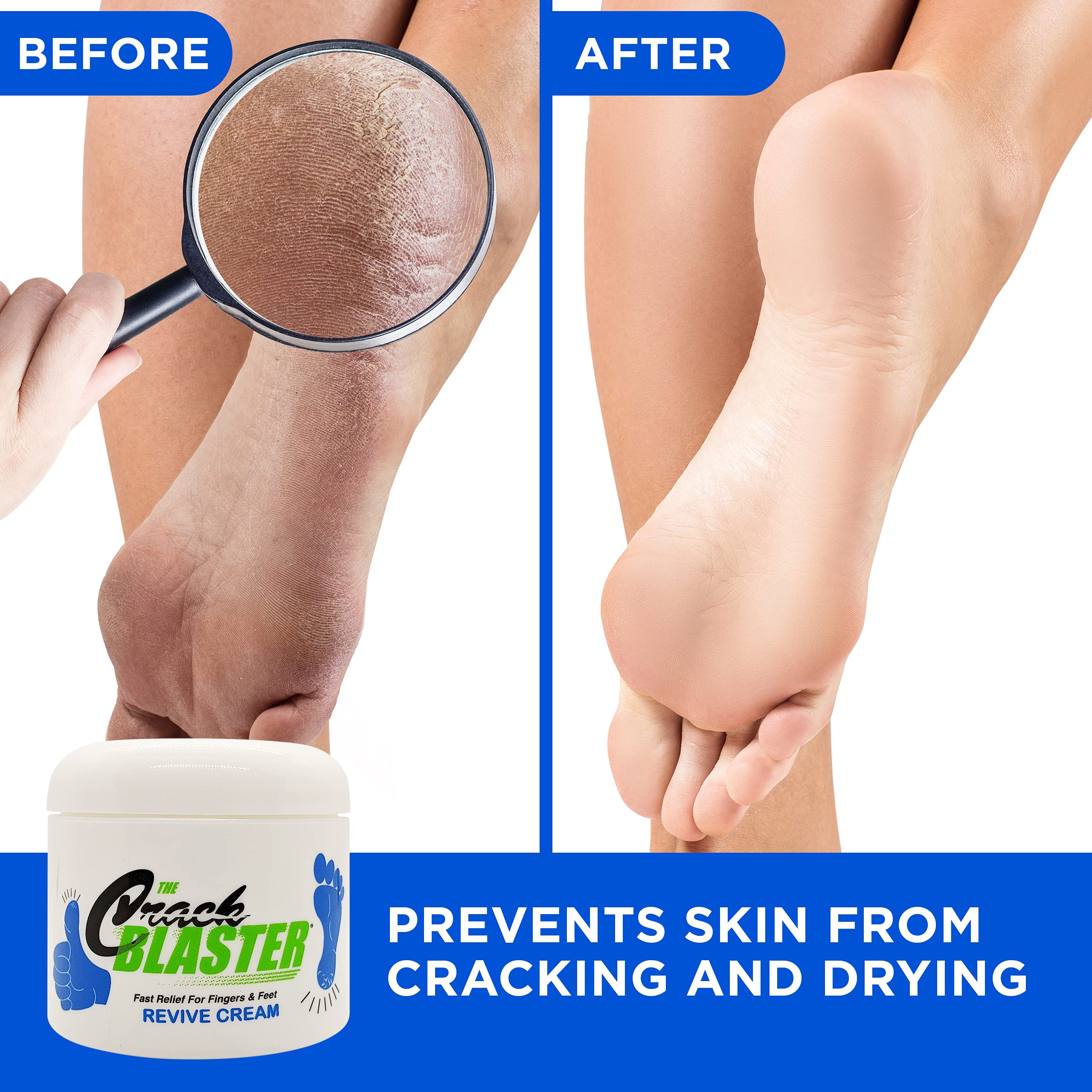 Dry Skin Lanolin Cream for Cracked Heels, Elbows and Soft Hands Crack Blaster Revive
