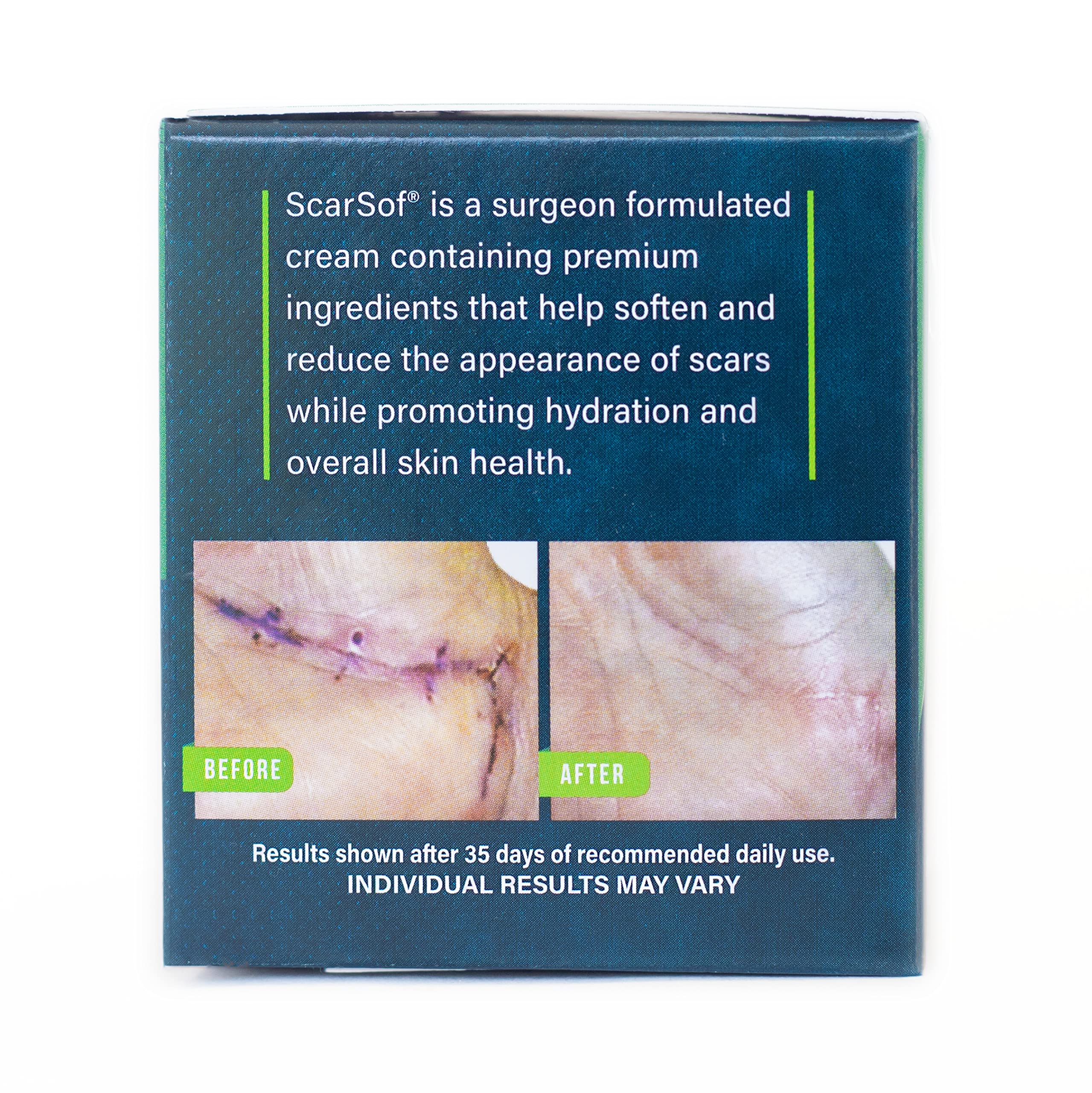 ScarSof Scar Cream - Advanced Scar Cream Made with 100% Organic Aloe Vera and All Natural Emu Oil - Helps Scar Appearance and Ov