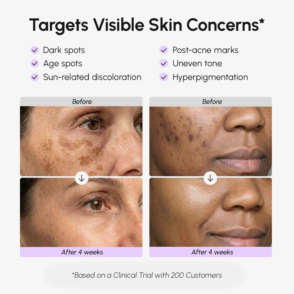 Face & Body Serum for Dark Spots