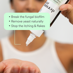Calming Seborrheic Serum