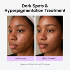 Dark Spot Corrector