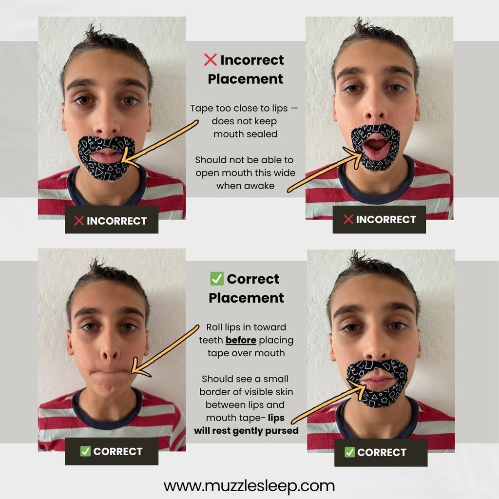 Muzzle® Mouth Tape For Youth (Medium Hold)