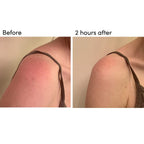 BODY 301: After-Sun Aloe Wipes (Pack of 15)